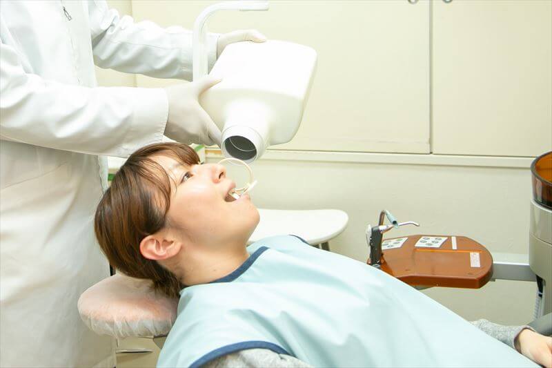 レントゲン撮影