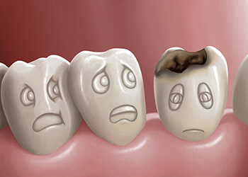 虫歯、気づかないふりしていませんか？