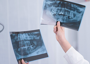 歯科用CTを用いた精密な診断が欠かせません