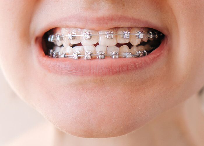 現状をしっかり診断、成長過程を予測した治療計画を    