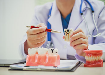 悪化した虫歯を抜歯から救うために～根管治療～