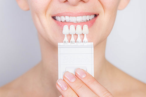 安心できる歯科医院でリーズナブルに医療ホワイトニングを