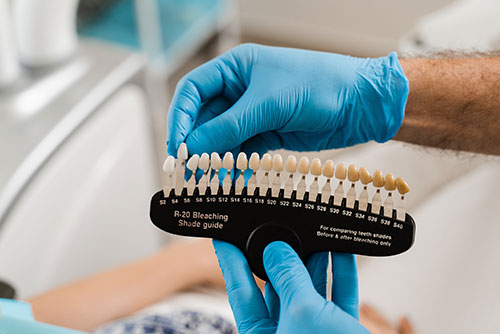 薬剤で歯を理想的な輝く白さへ導きます