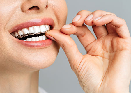 再来院・マウスピースと薬剤のお渡し