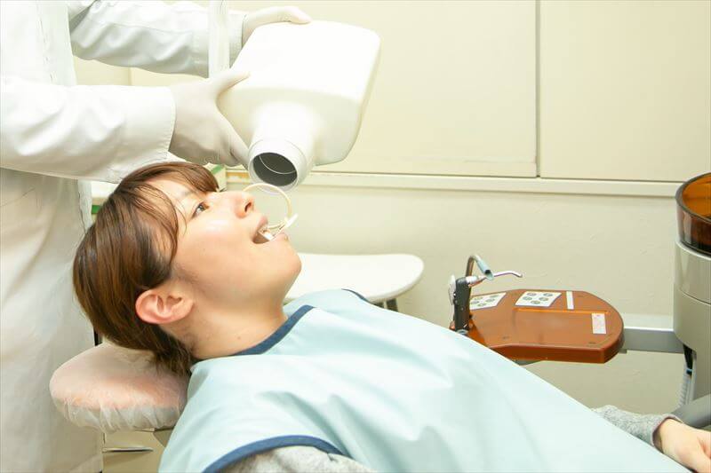 レントゲン撮影